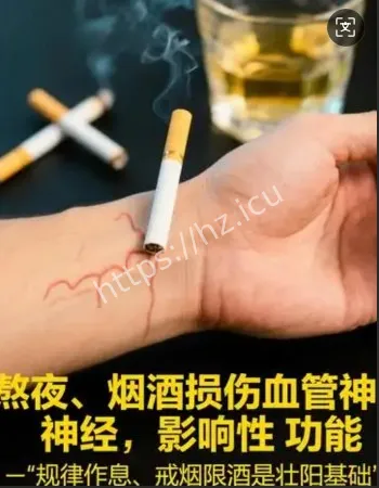 心源性猝死