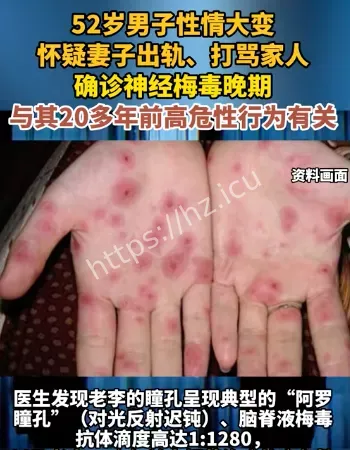 男子梅毒晚期